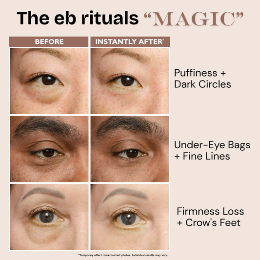 קרם מיצוק עיניים זמני