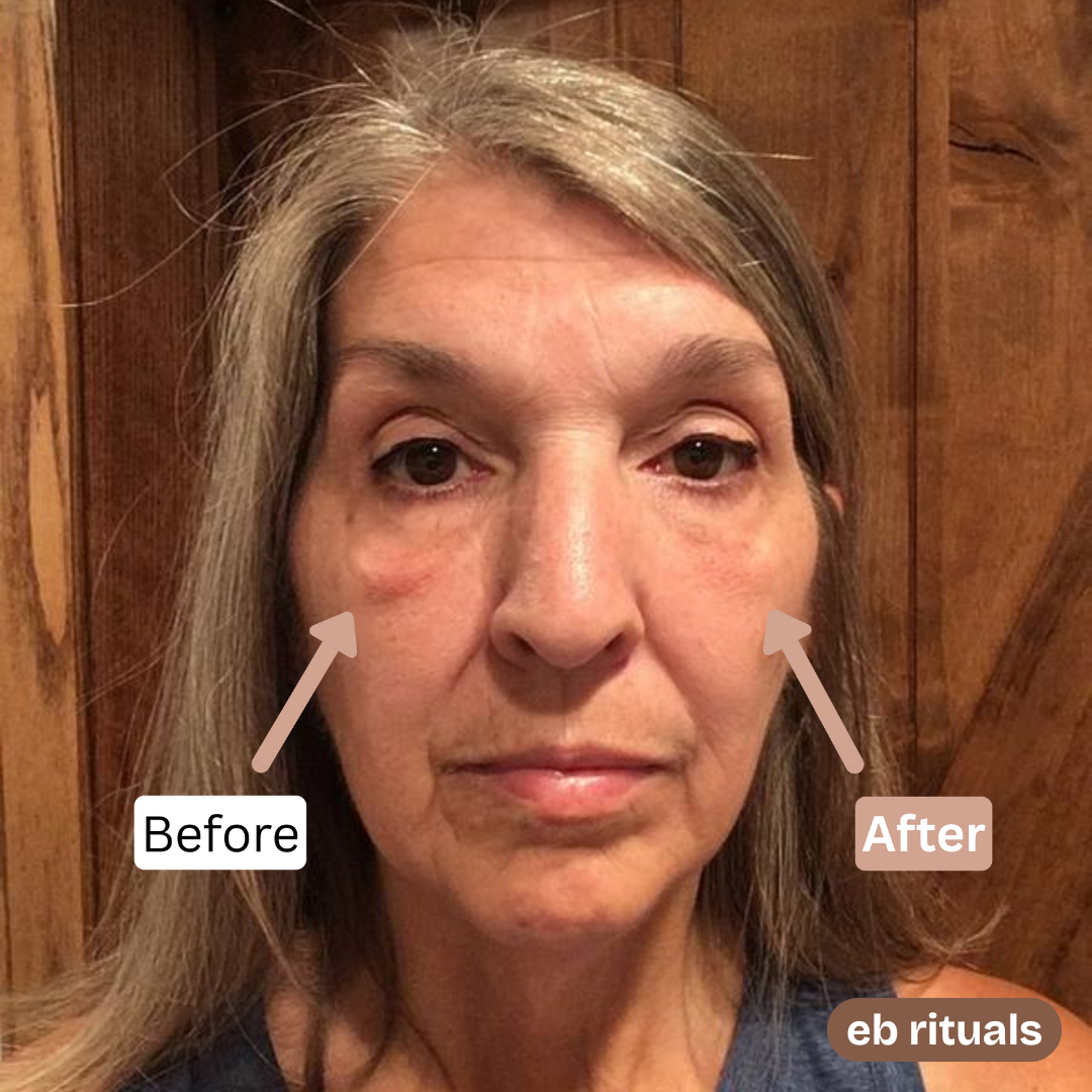 קרם מיצוק עיניים זמני