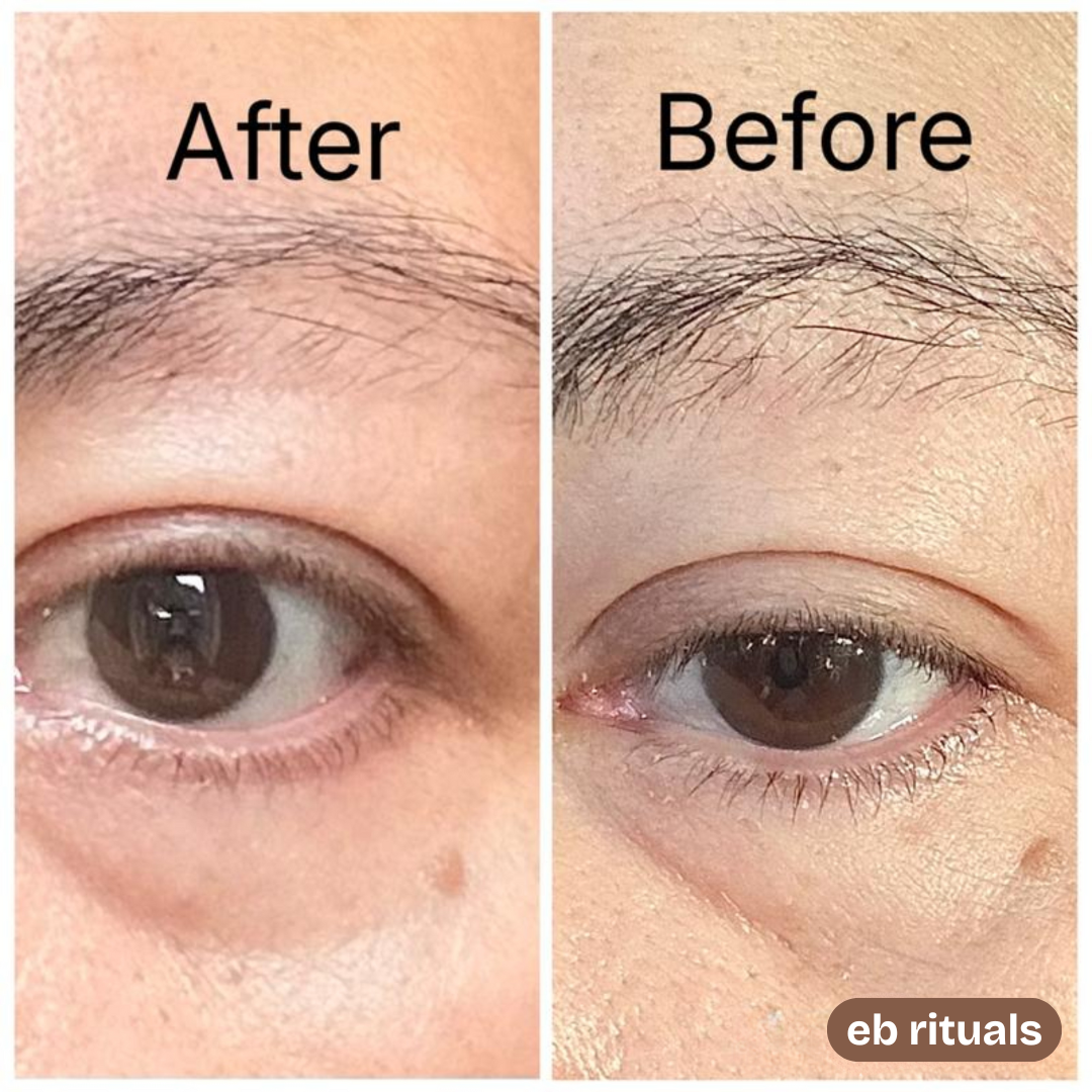 קרם מיצוק עיניים זמני